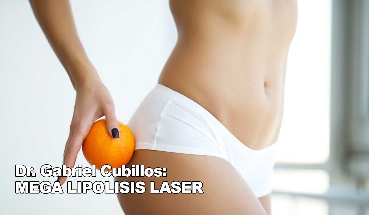 Dr. Gabriel Cubillos: Experto discute los beneficios de la lipolisis láser Dr. Gabriel Cubillos: Experto discute los beneficios de la lipolisis láser